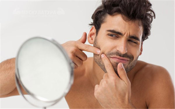 Проблемная кожа: советы эксперта о том, как ухаживать за кожей лица